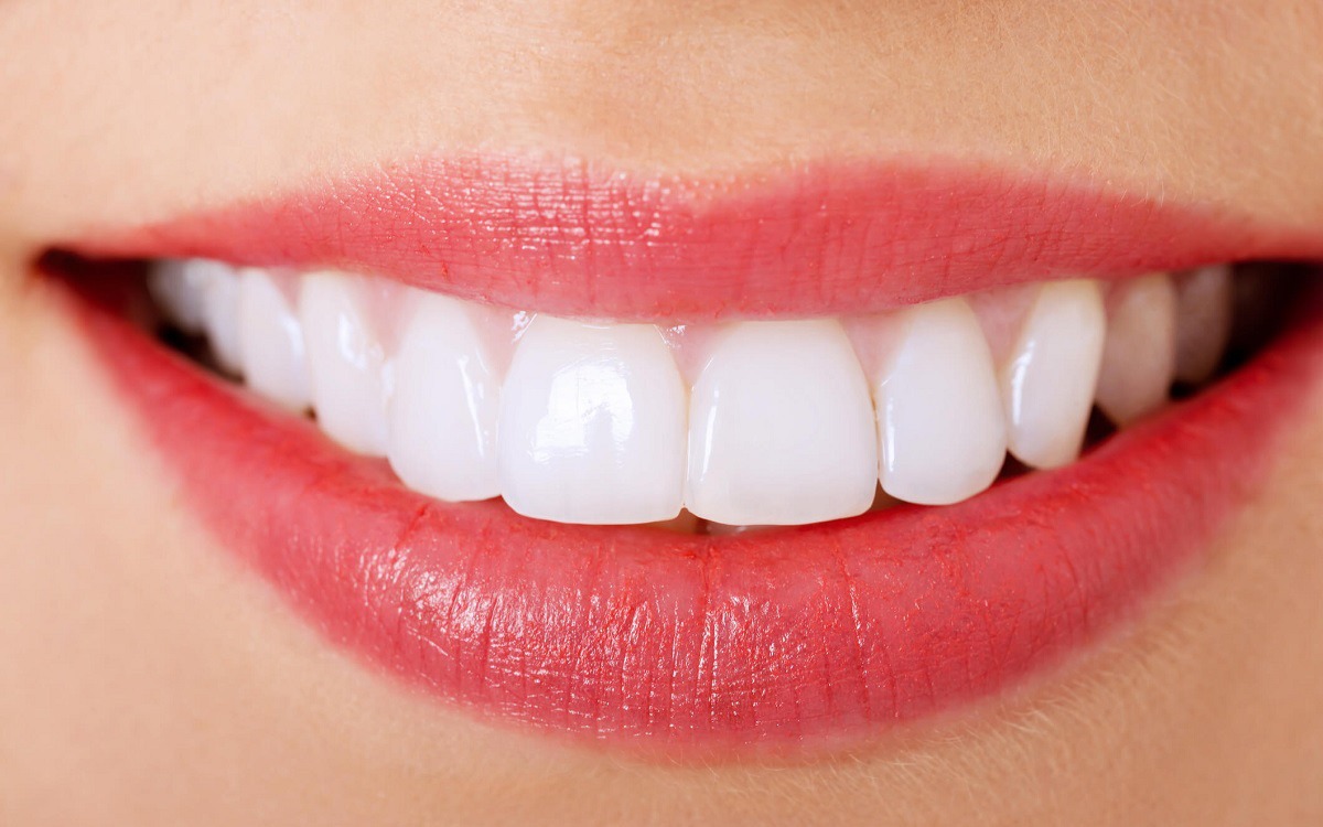 Beautiful white teeth