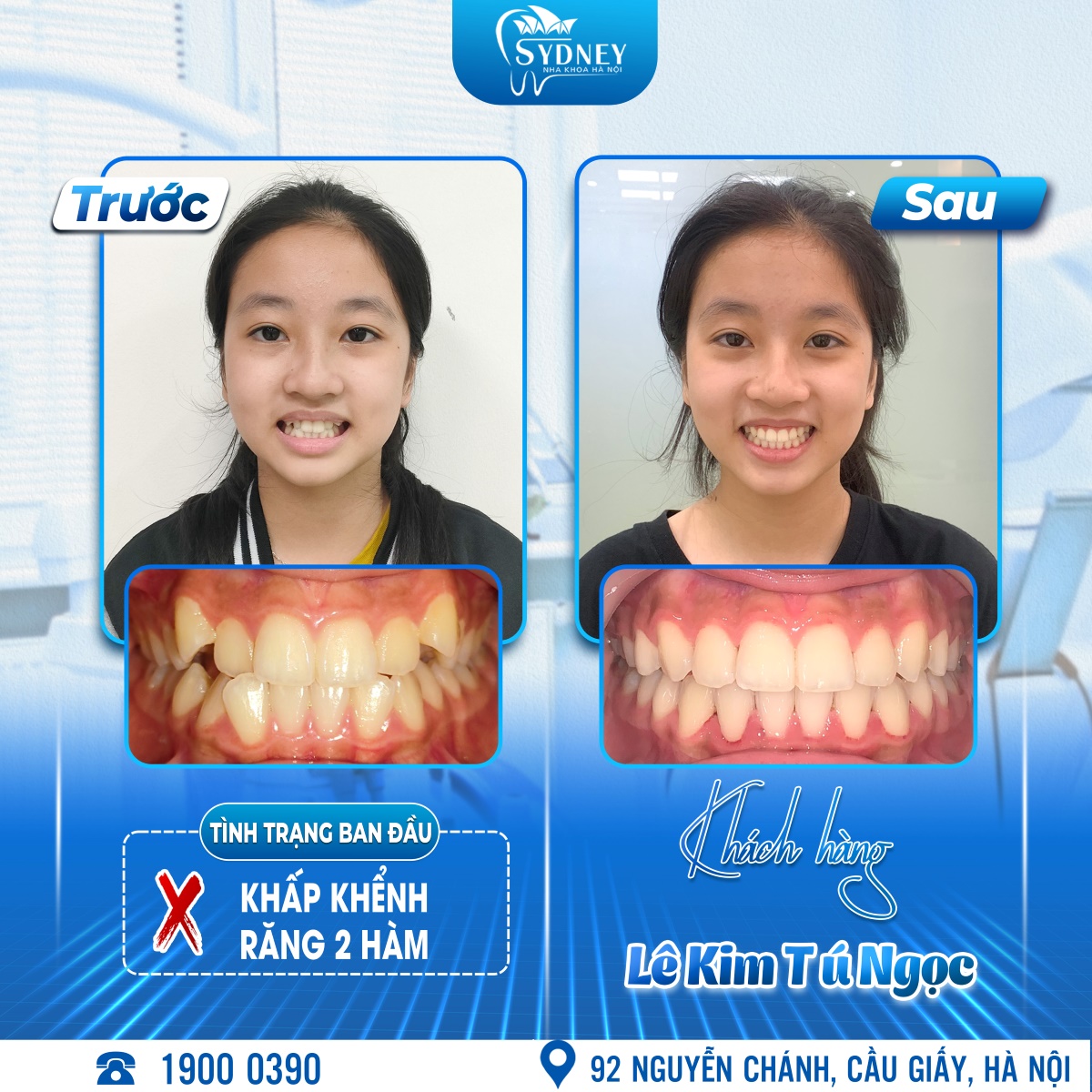 Lê Kim Tú Ngọc
