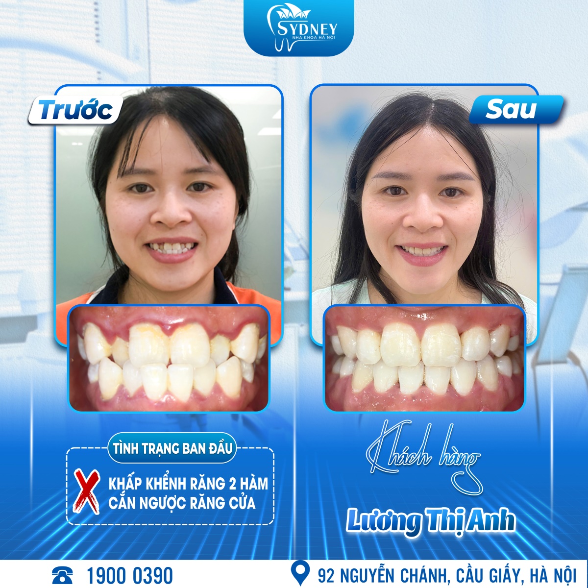 Lương Thị Ánh