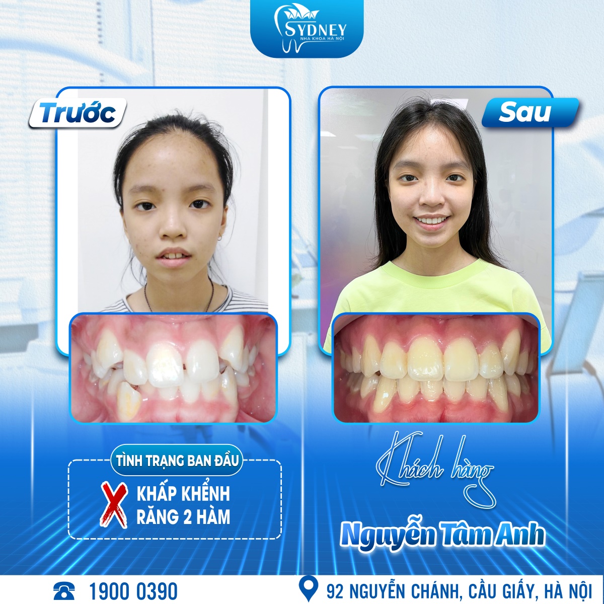 Nguyễn Tâm Anh